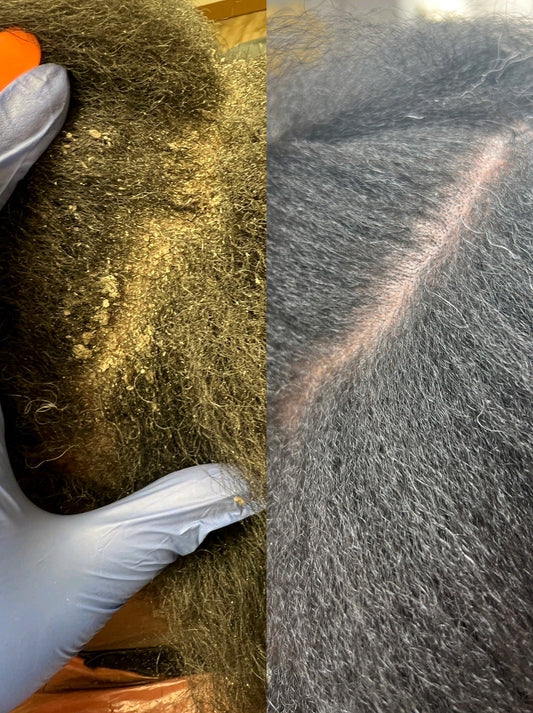 Types of Hair Loss Explained