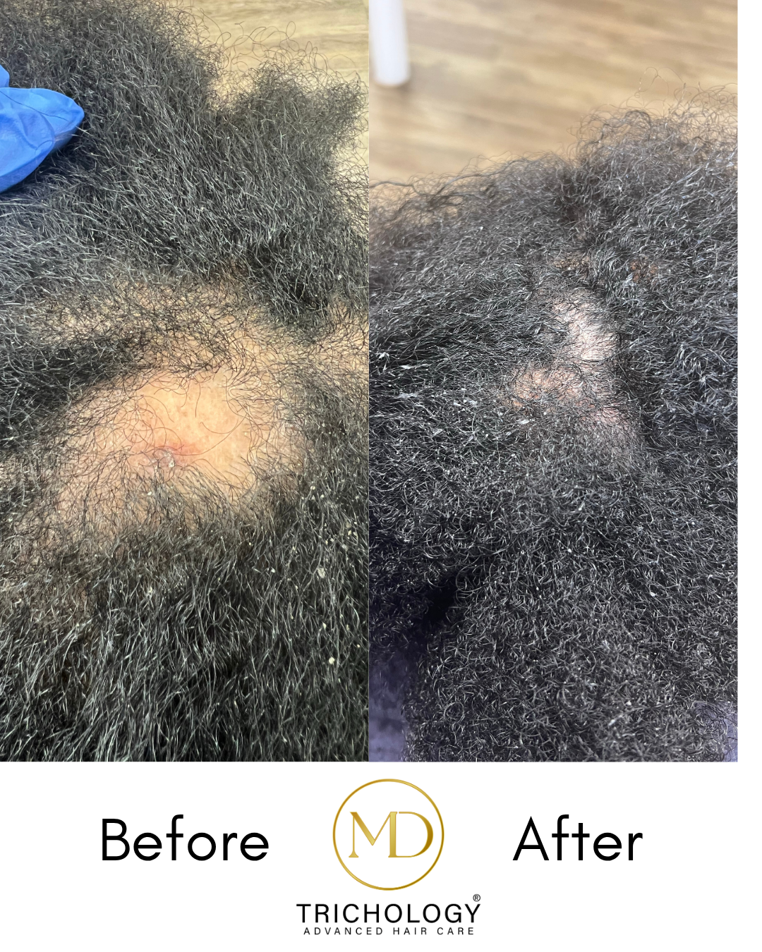 Virtual Hair & Scalp Consultation — Limited-Time $97 Promo